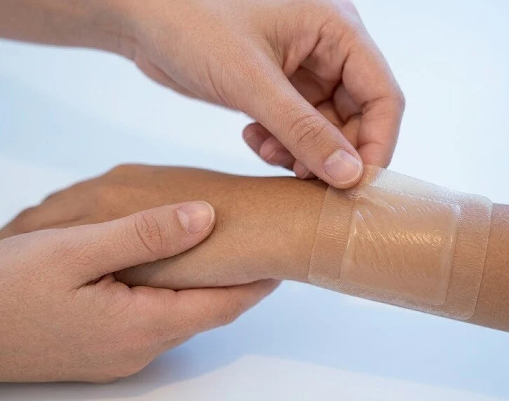 A person gently applying a clear silicone patch to their wrist - silicone patch for scar -2
